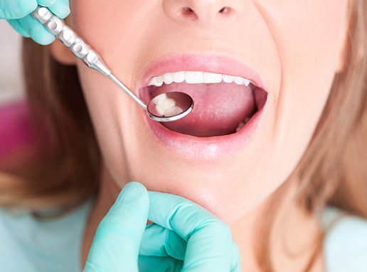 Dentist examining patient's smile after metal free dental restoration